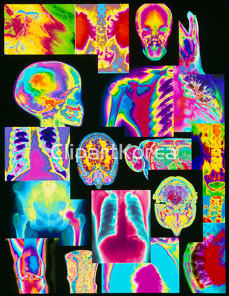해외작가포토 - 클립아트코리아 :: 통로이미지(주) MRI,__적합한콘텐츠,다양함,라이트박스,엑스레이,해외포토,해외프리미엄콜렉션